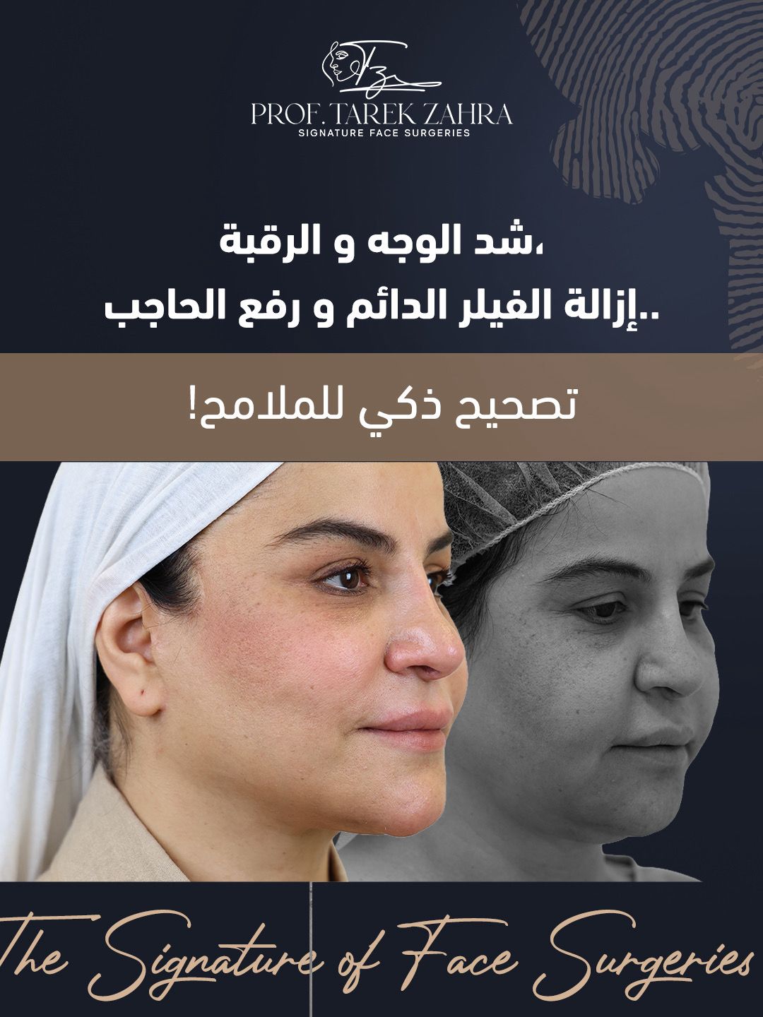 نتائج شد الوجه والرقبة